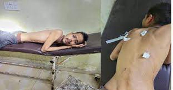 1 आशिक की 2 महबूबा: डबल गेम के चक्कर में EX गर्लफ्रेंड ने ब्वॉयफ्रेंड को मारी कैंची