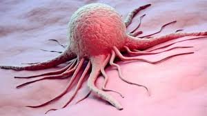 cancer : कैंसर क्या होता है , इससे बचाव और लक्षण