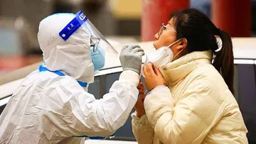 RT-PCR