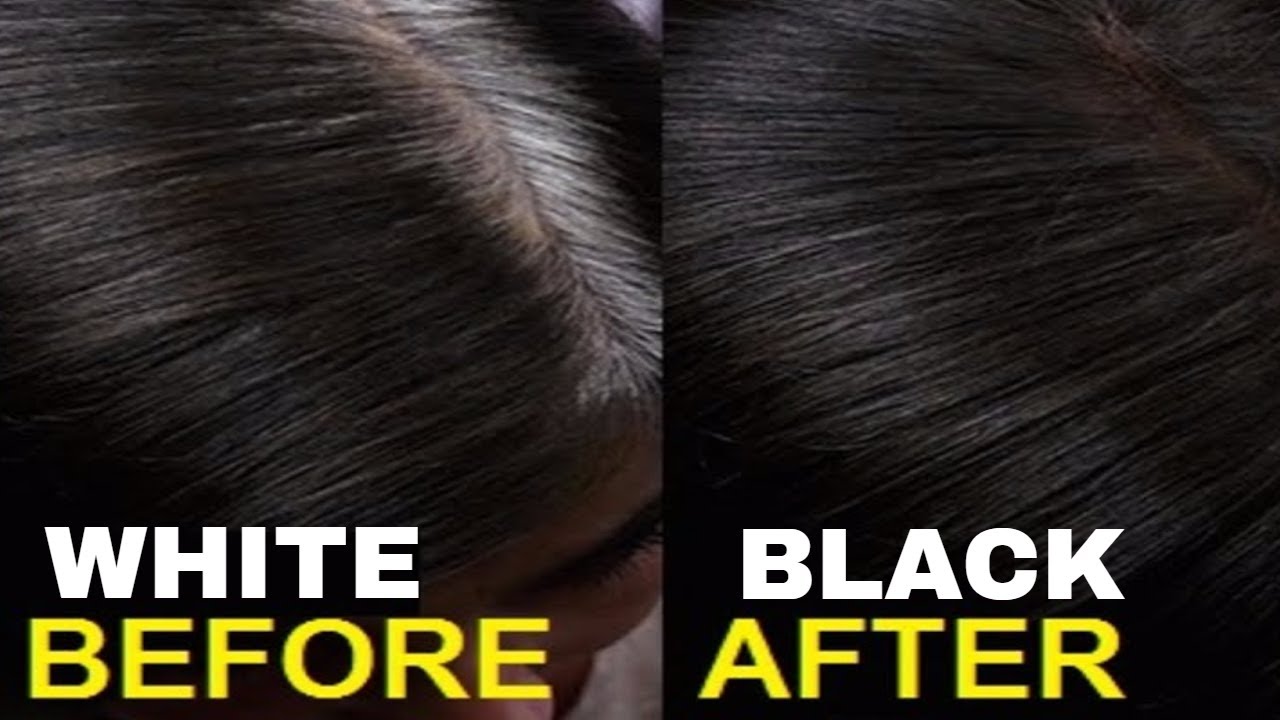 Hair Care: बिना डाई के सफ़ेद बालो को काला करने के लिए अपनाये नारियल तेल के नुस्खे