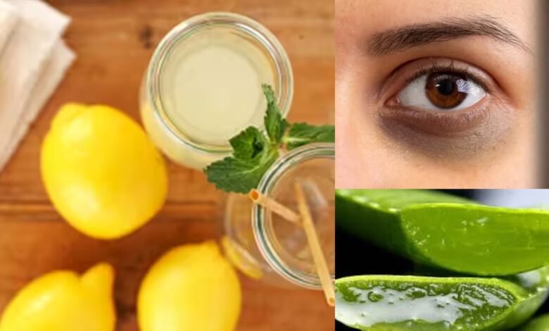 क्या आप है Dark Circle's से परेशान तो फॉलो करे इस होम मेड रेमिडी को