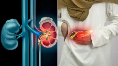 पथरी से छुटकारा पाने के लिए अपनाए ये घरेलू नुस्खे,मिलेंगे जबरदस्त फायदे
