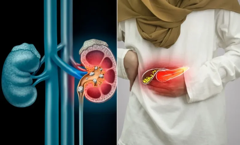 पथरी से छुटकारा पाने के लिए अपनाए ये घरेलू नुस्खे,मिलेंगे जबरदस्त फायदे