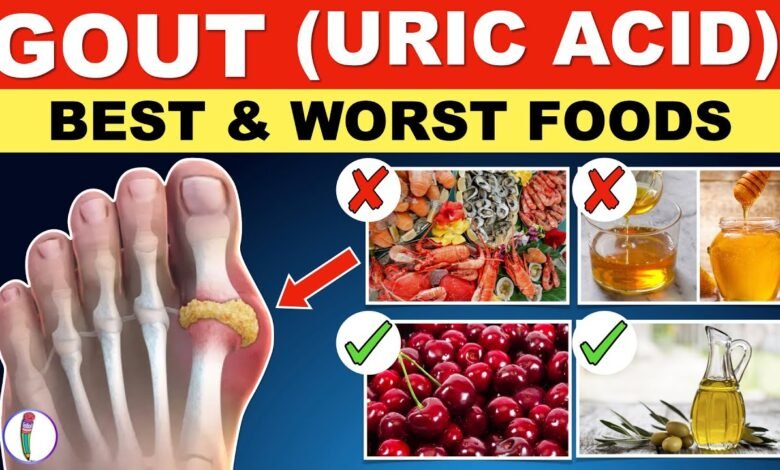 High Uric Acid Diet: जरूरत से ज्यादा यूरिक एसिड बढ़ जाने कारन,हो सकती है कई बीमारिया जाने control करने की डाइट