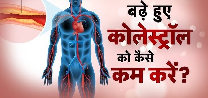 बैड कोलेस्ट्रॉल शरीर में जाकर ही कर देता है शरीर के इन हिस्सों को Demise,जाने इसे रोकने के उपाय