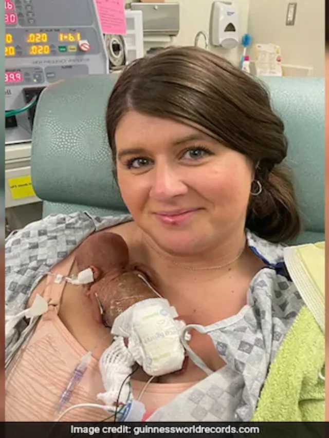 पैदा होते ही गिनीज वर्ल्ड रिकॉर्ड में दर्ज हुआ इस बच्चे का नाम, महज 21 हफ्तों में हुआ जन्म, जानें पूरा मामला