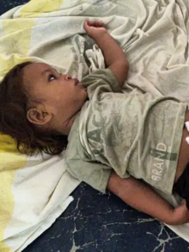 एक साल के बच्चे ने एक सांप को दांत से काट लिया जिसके बाद सांप की मौत हो गई.