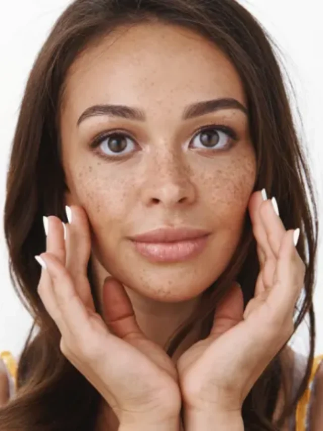 काली भद्दी झाइयों ने कर रखा है परेशान तो मान लें डॉक्टर की ये बातें, साफ हो जाएगा चेहरा